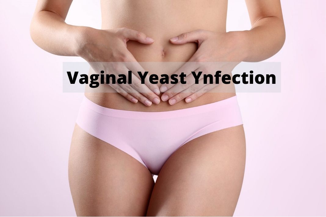 Vaginal Yeast Infection Causes And Solutions Go Lifestyle Wiki My Xxx Hot Girl