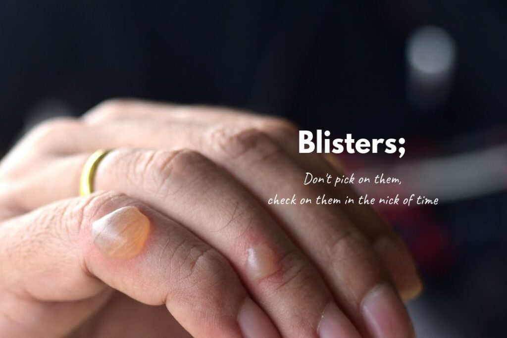 Blisters