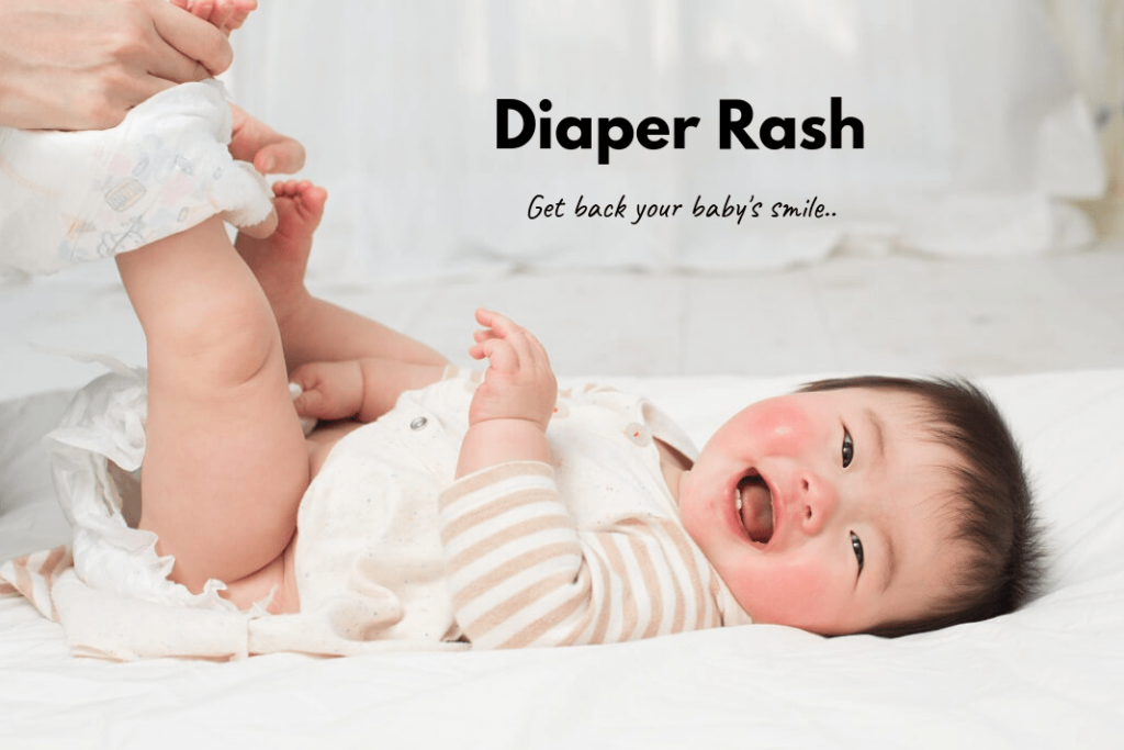 Diaper Rash