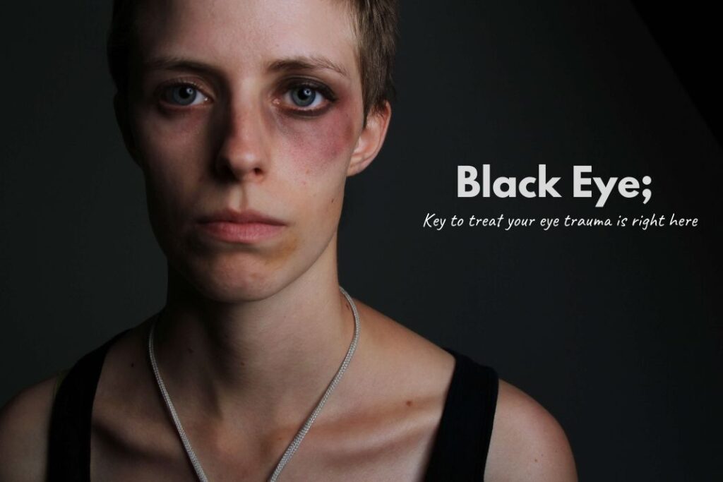 Black Eye