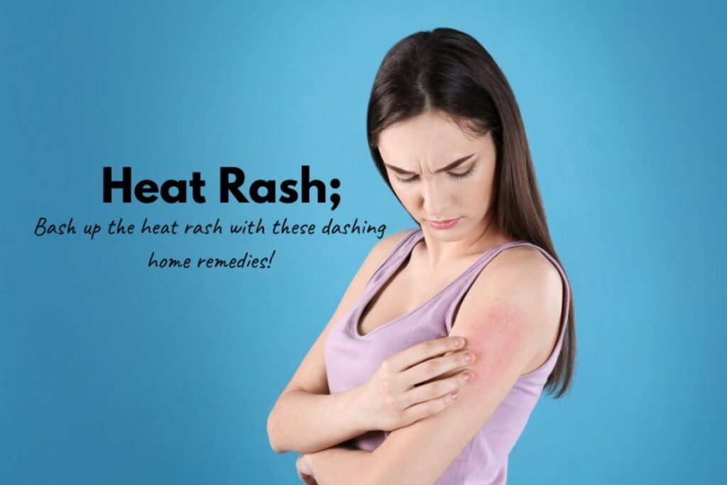 How To Cure Heat Rash