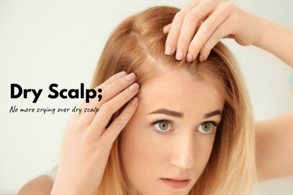 get rid of dry scalp