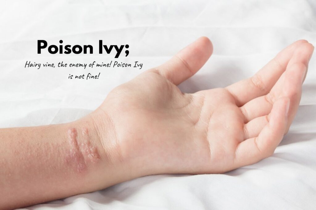 get rid of poison ivy rash