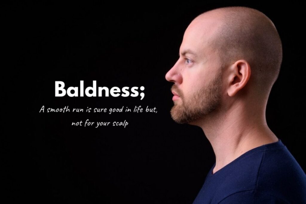 how to cure baldness