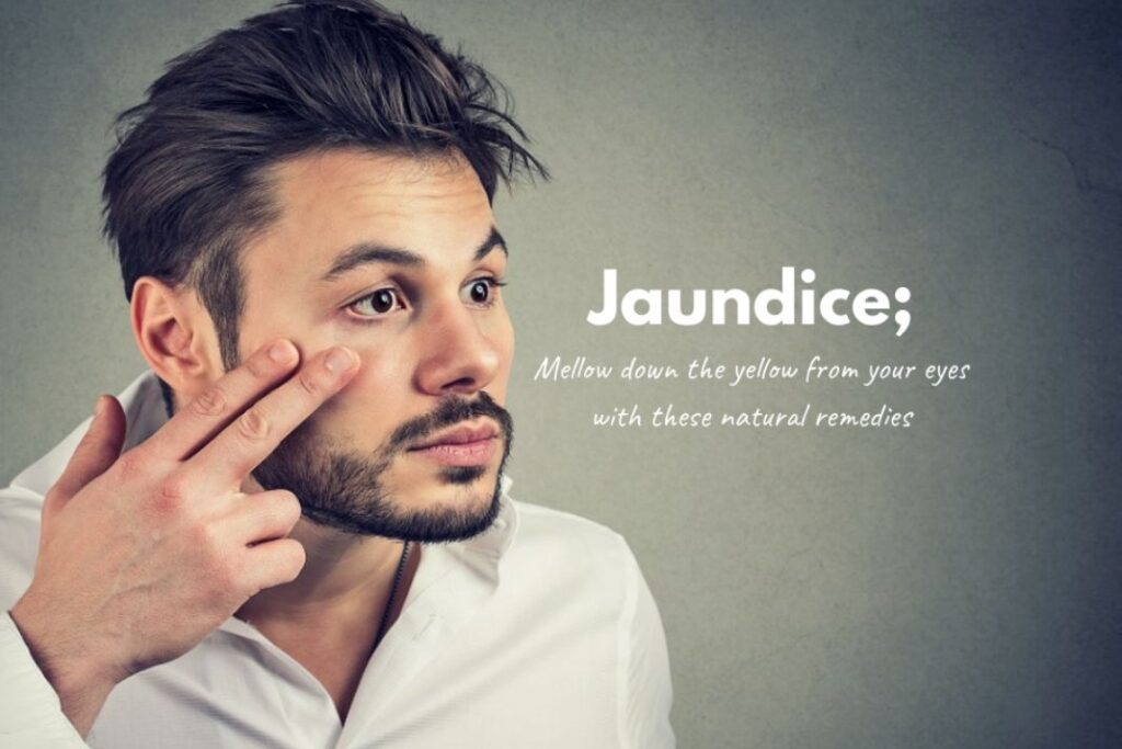 how to treat jaundice