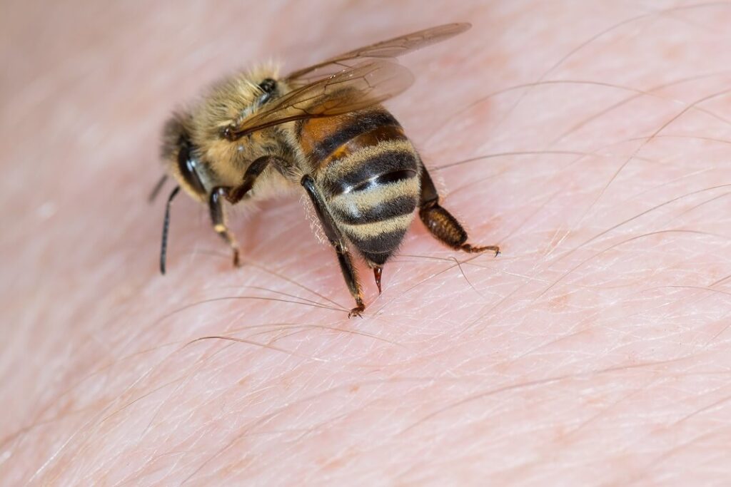 Home Remedies For Bee Stings